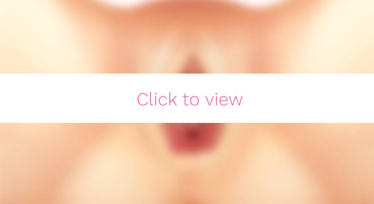 Toronto Labiaplasty Labia Reduction Trim All Female Staff