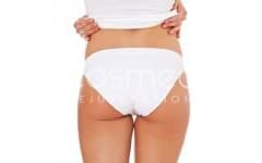 Fat Injections vs. Implants – Brazilian Butt Lift 101