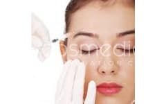 Juvederm vs. Other Fillers