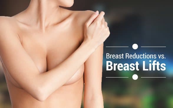 What’s the Difference Between a Breast Reduction and a Breast Lift?