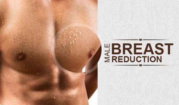 What Is Involved In Male Breast Reduction Surgery?