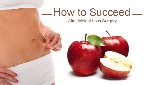 How to Succeed After Weight Loss Surgery