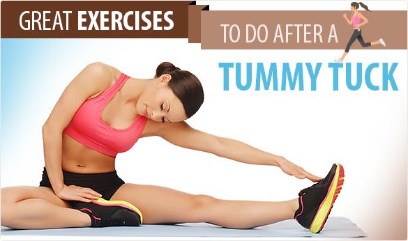 Six Great Exercises To Do After A Tummy Tuck