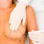 At What Age can a Woman Undergo Breast Reduction?