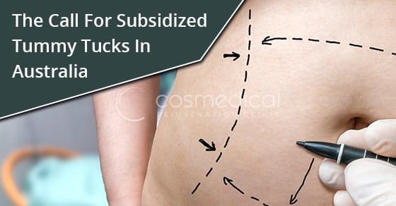 The Call for Subsidized Tummy Tucks in Australia