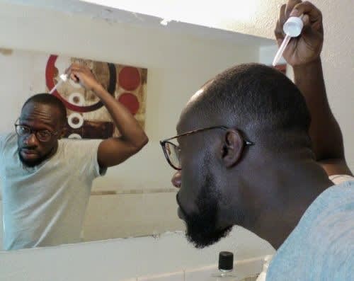 How To Use Minoxidil Solution The Best Way To Apply The Hair Loss Treatment