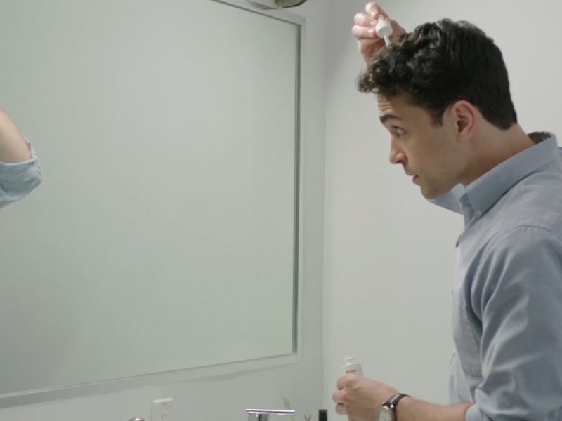 6 Simple Minoxidil Hair Styling Tips Keeps Com