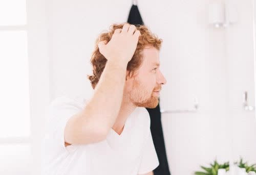 Yes Hair Loss Is Genetic