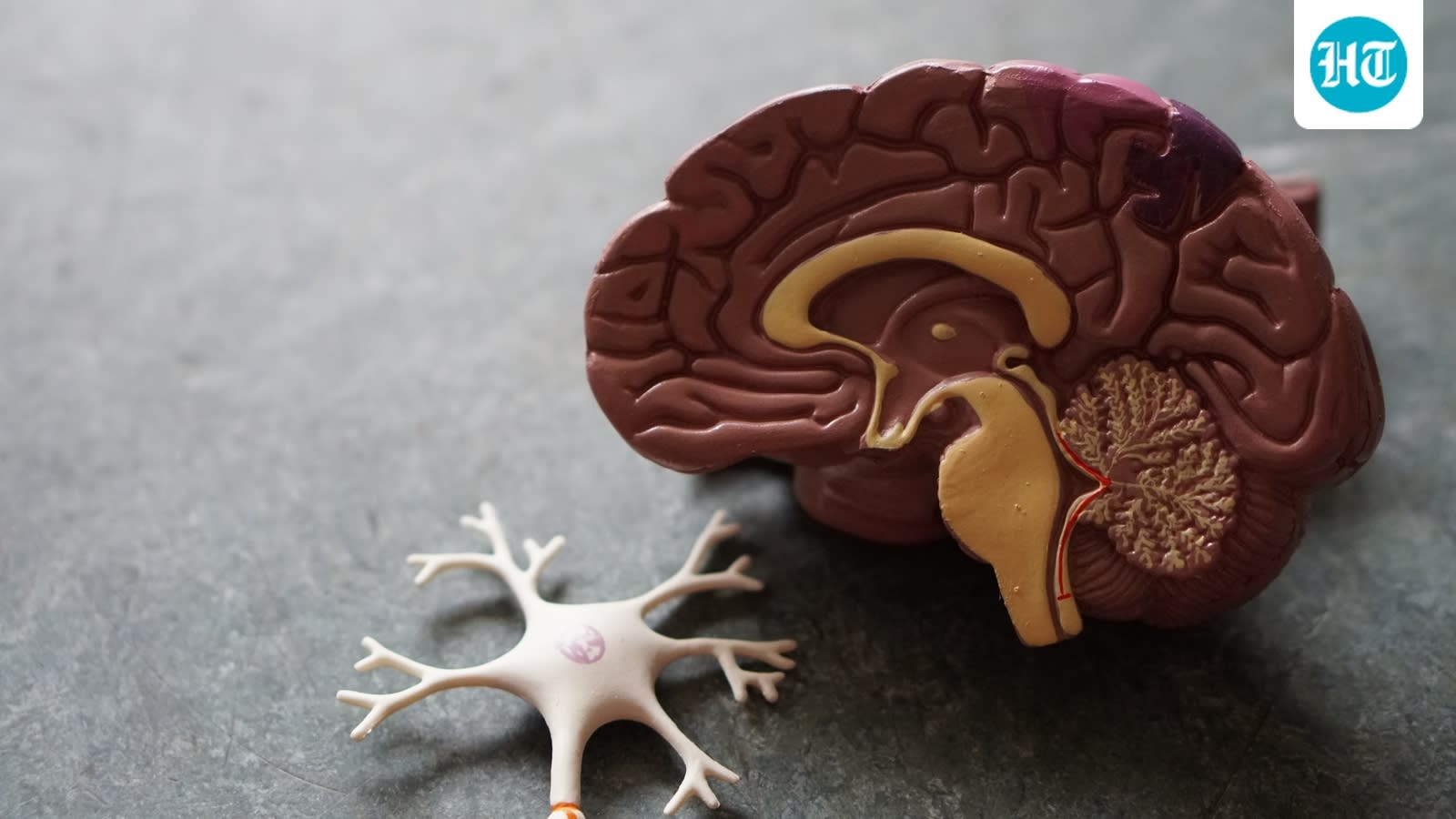 Can a 5-minute memory test detect Alzheimer’s? Neurologist shares what it can and cannot reveal