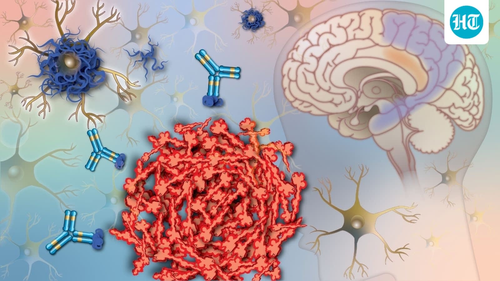 Is Alzheimer's in your DNA? Doctors reveal what your family history actually means and whether you should get tested