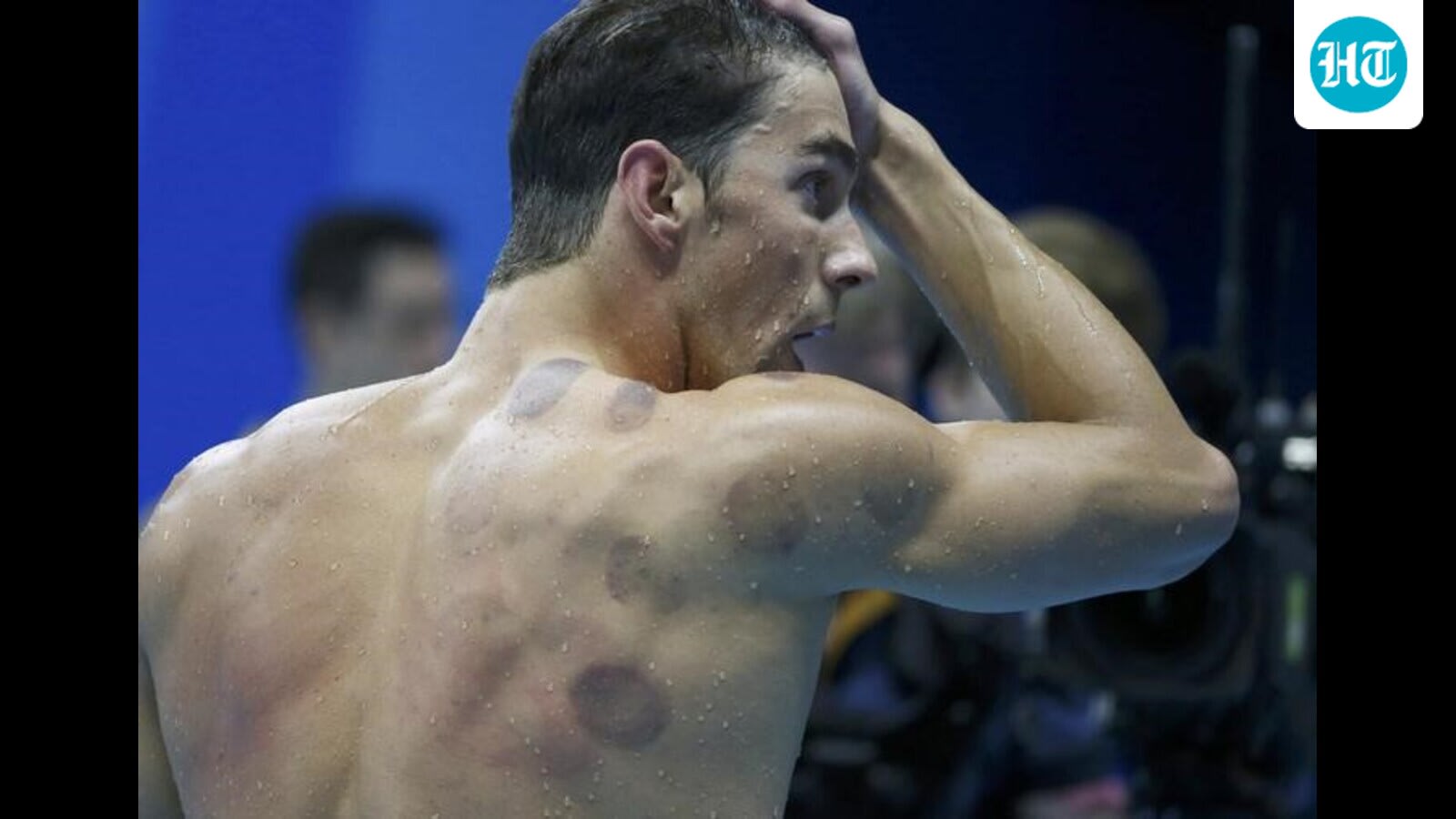 Cupping, ice baths and sleep: A deep dive into the science of recovery