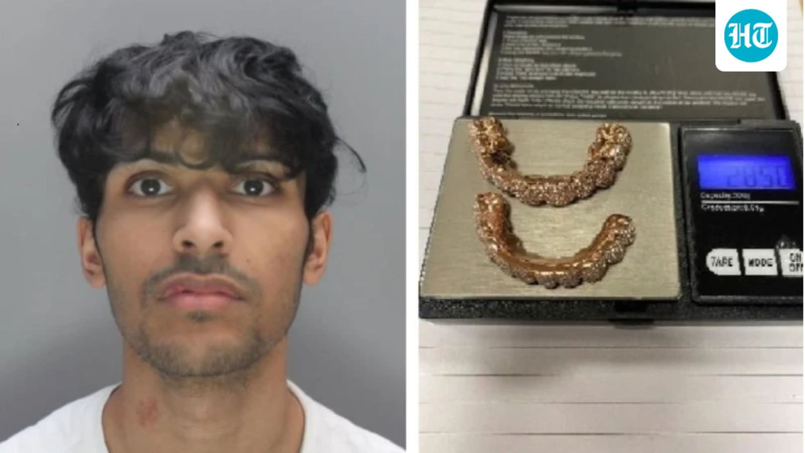 Gold teeth grills to luxury holidays: How UK man splurged after  ₹2.5 crore crypto theft