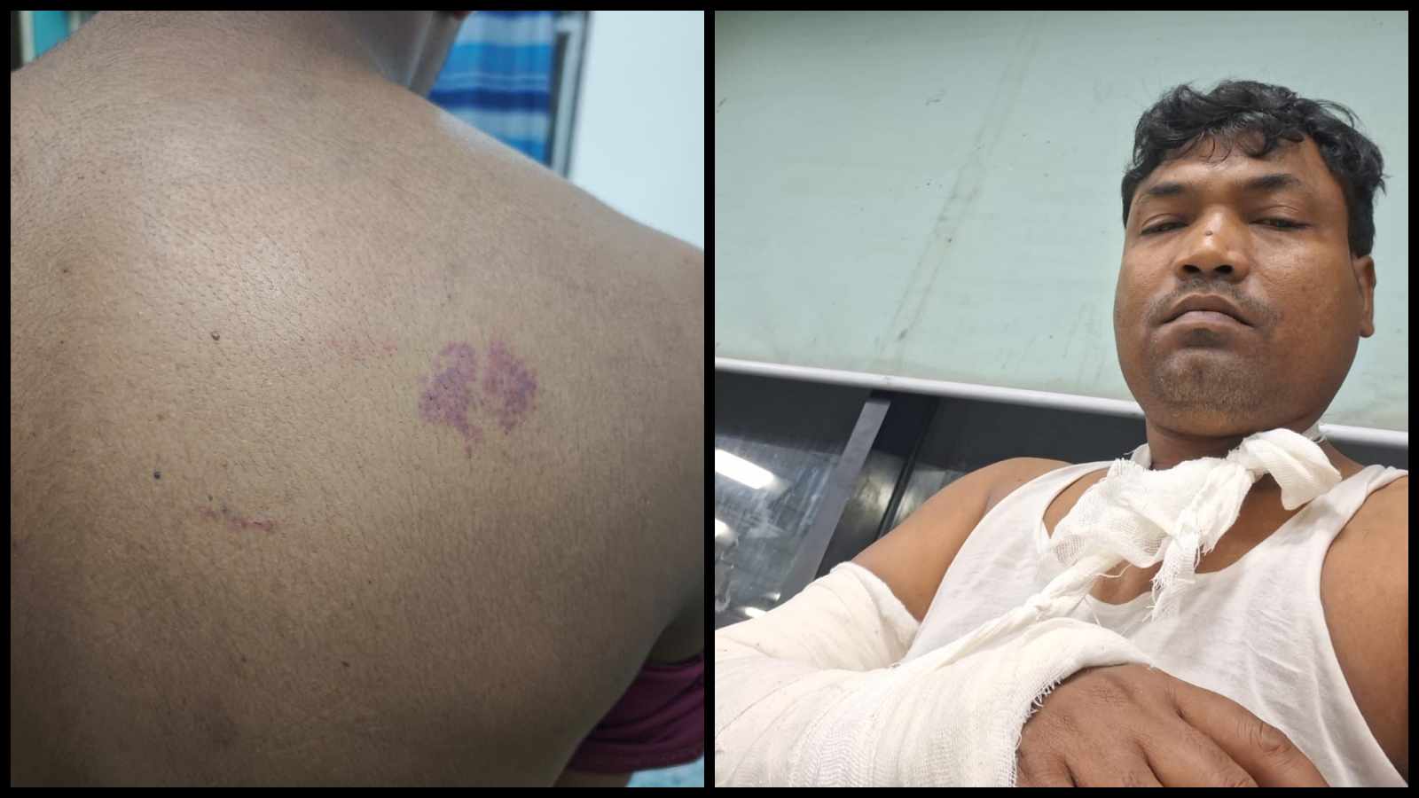 ‘Beaten with lathis, kicked’: Protesters say they were assaulted in detention