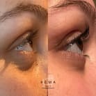 Lash lift