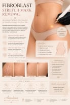 Fibroblast stretch marks REMOVAL