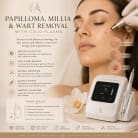 Milia korn REMOVAL