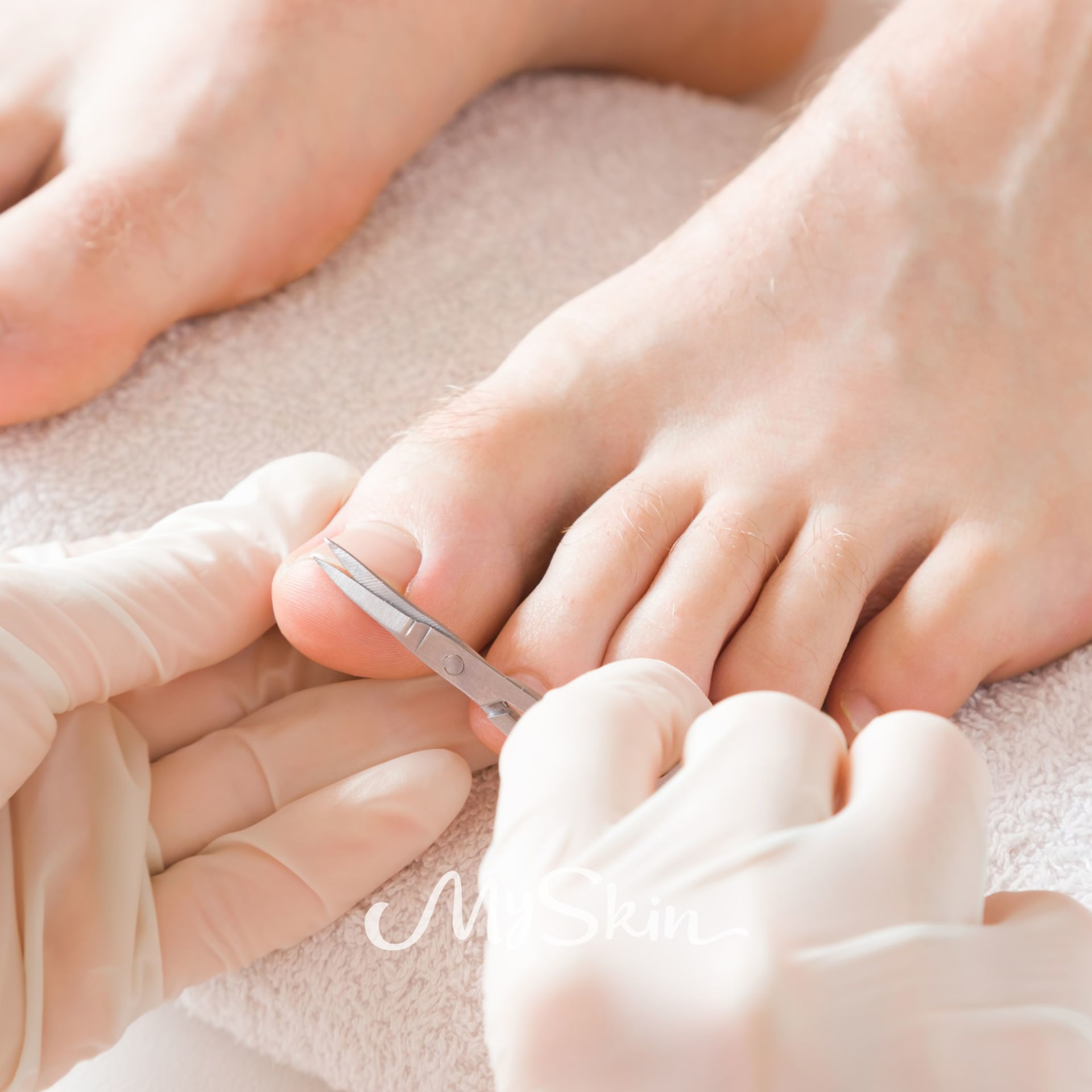 Nehtová korekce Podofix