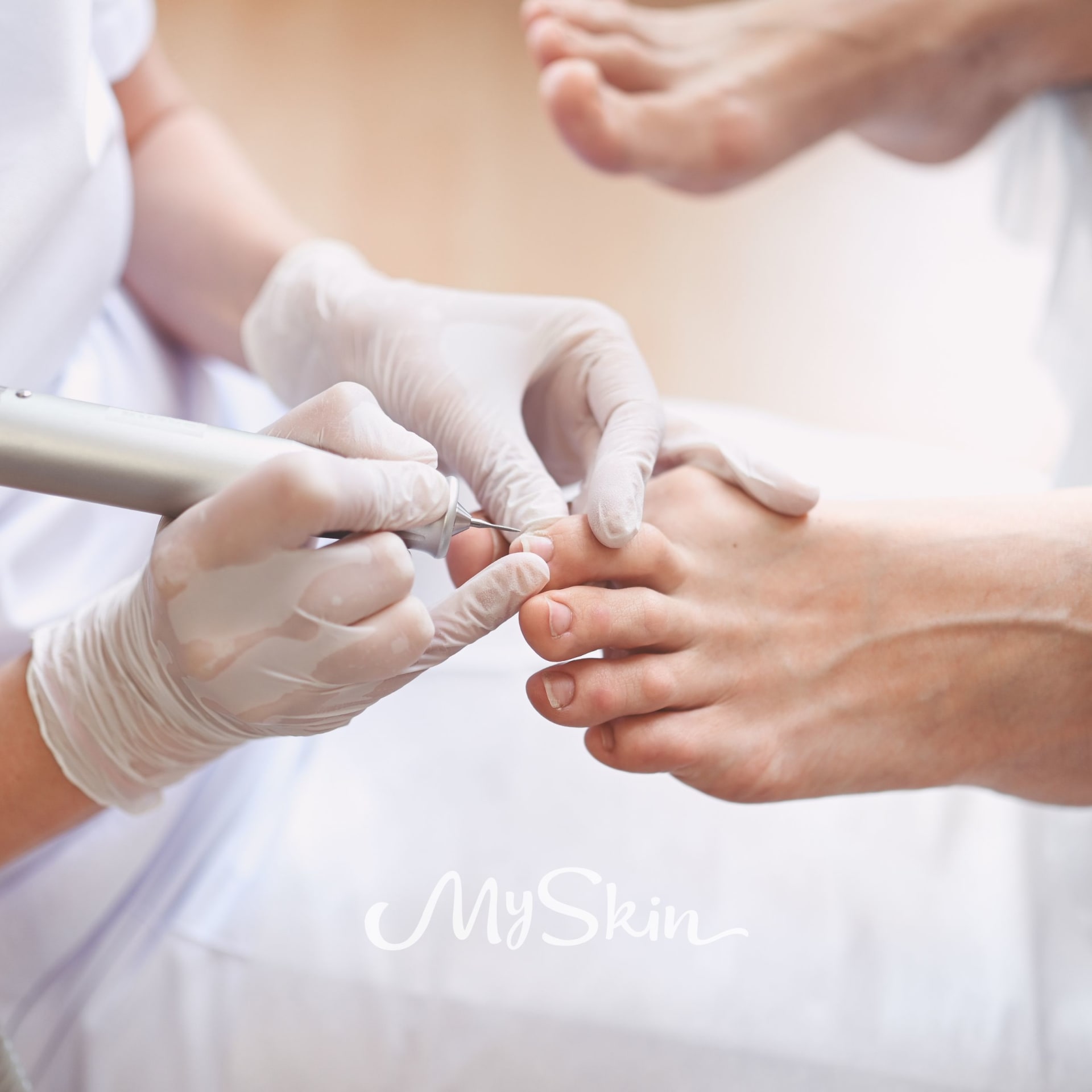 Suchá přístrojová pedikúra 