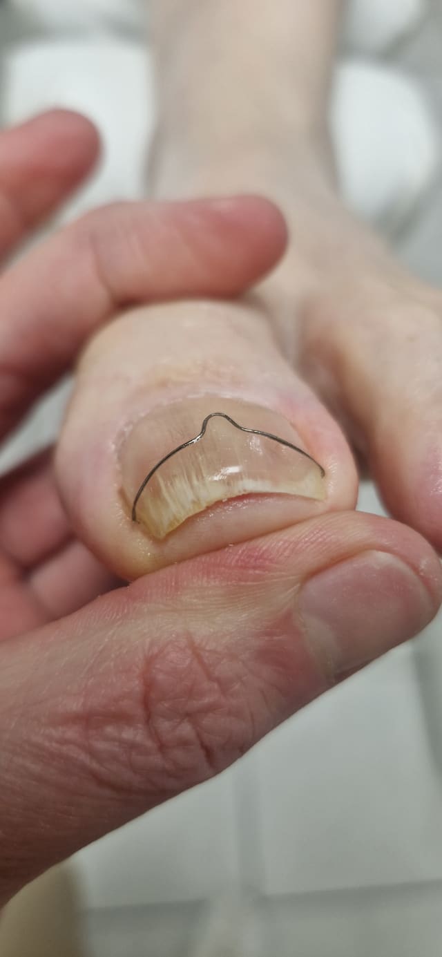 Fótaaðgerðastofan Furugerði 1