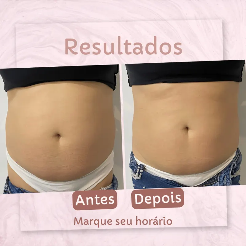 Imagem de capa