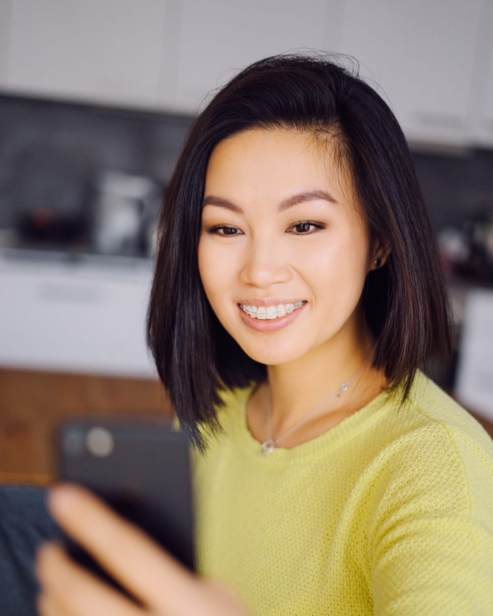 Close-up of a smile with ceramic braces