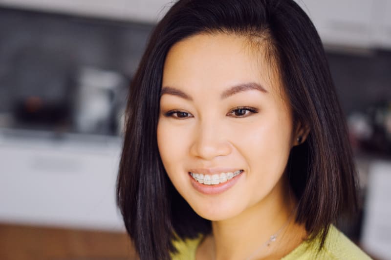 Close-up of a smile with ceramic braces