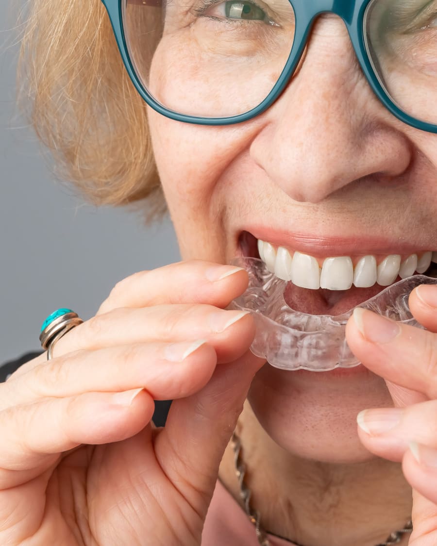 Patient placing a clear removable retainer