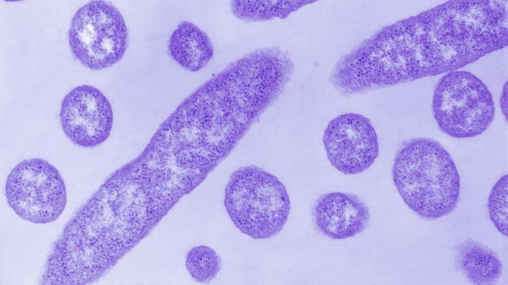 NYC Legionnaires’ Disease Outbreak