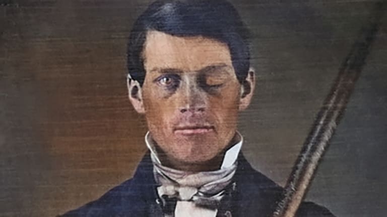 Phineas Gage