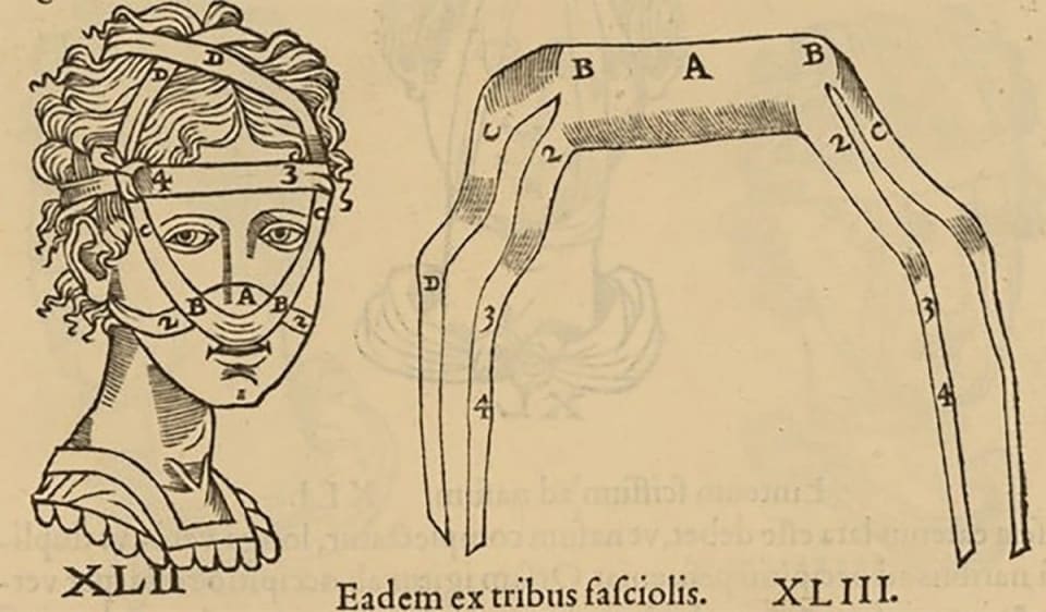Rhinoplasty and the History of Plastic Surgery: How Ancient India Helped Rebuild the Human Face