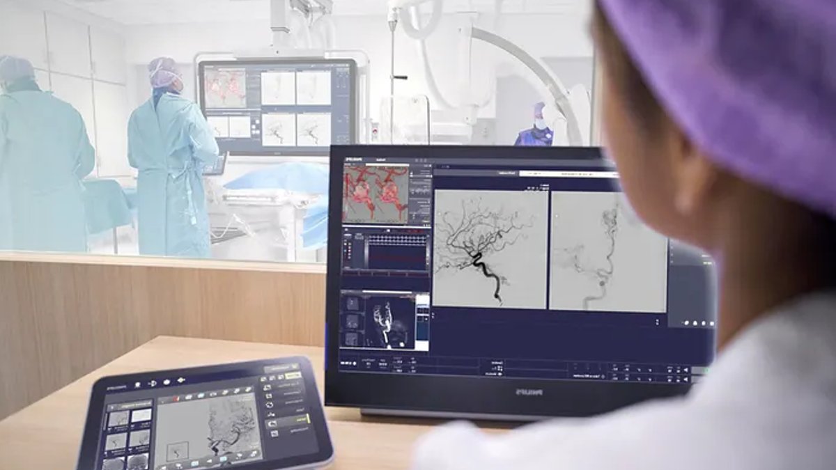 Philips invests $33.7M to develop stroke robot Philips invests $33.7M to develop stroke robot - philips stroke robot