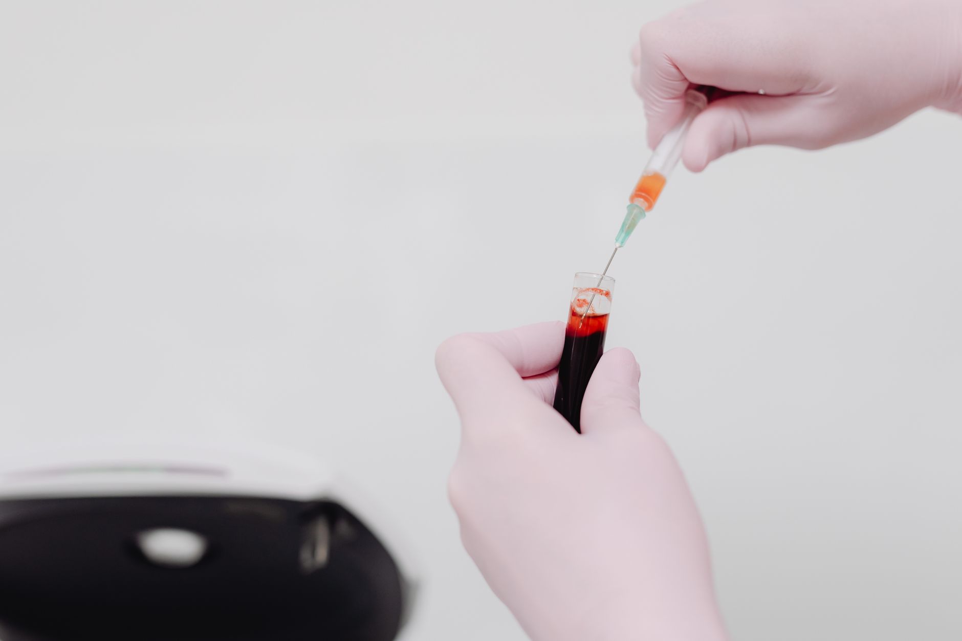 Study Shows Ferroptosis Vulnerability in AML