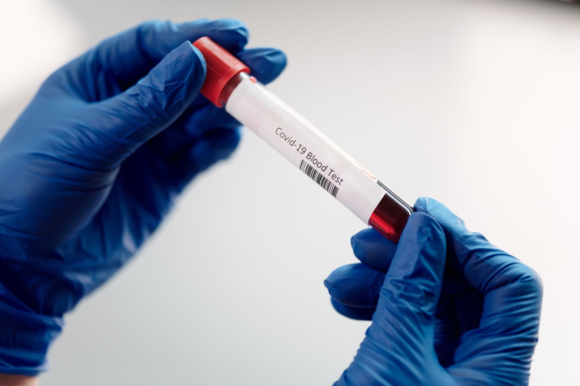 ProMIS Alzheimer’s Antibody Shows Promising Early Results