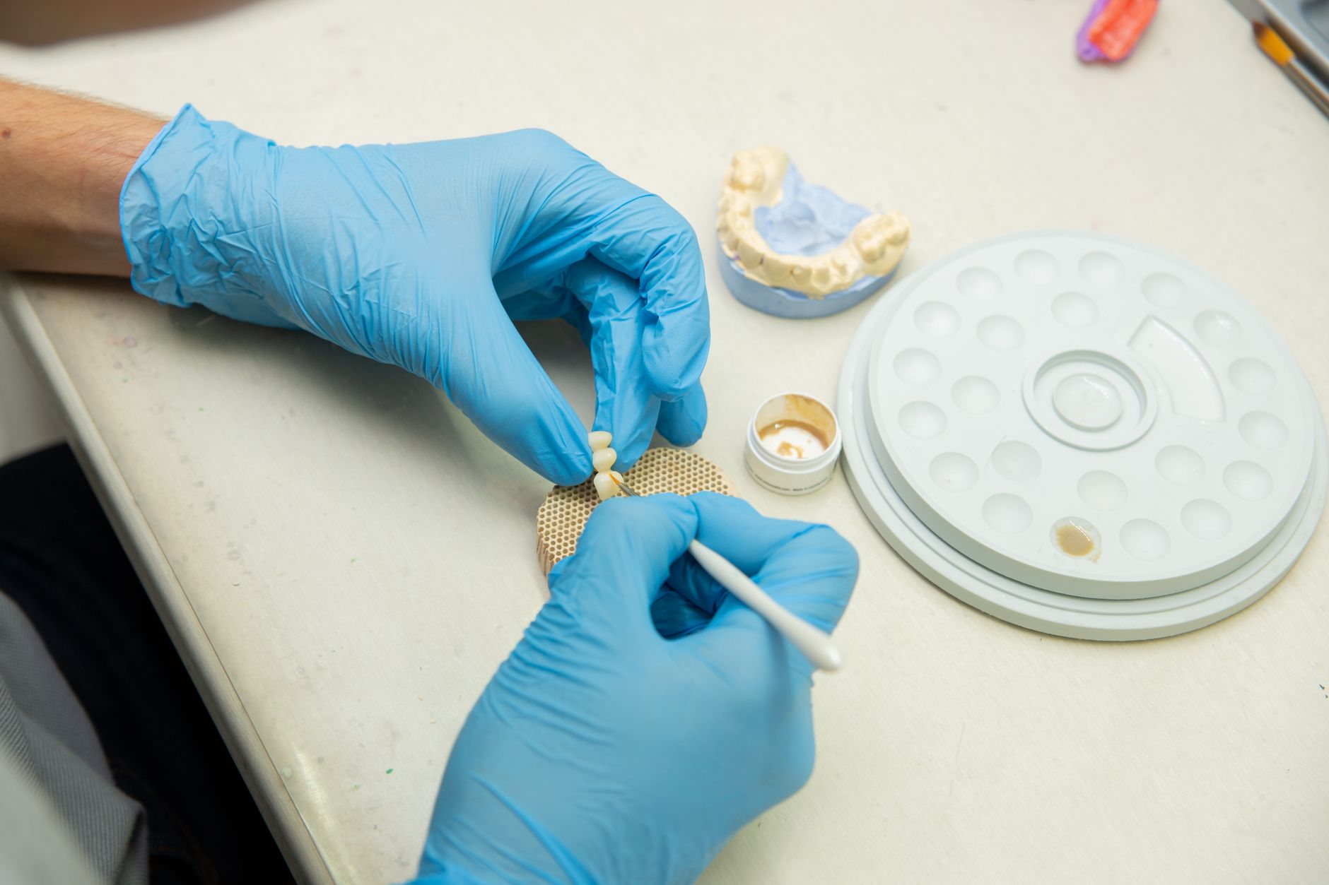 Maintaining Your Dental Implants: Tips for Long-Term Success