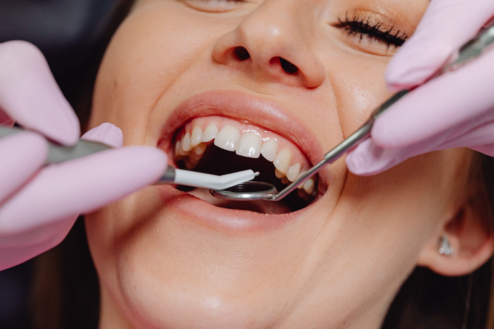 Why Regular Check-ups with a General Dentist are Essential