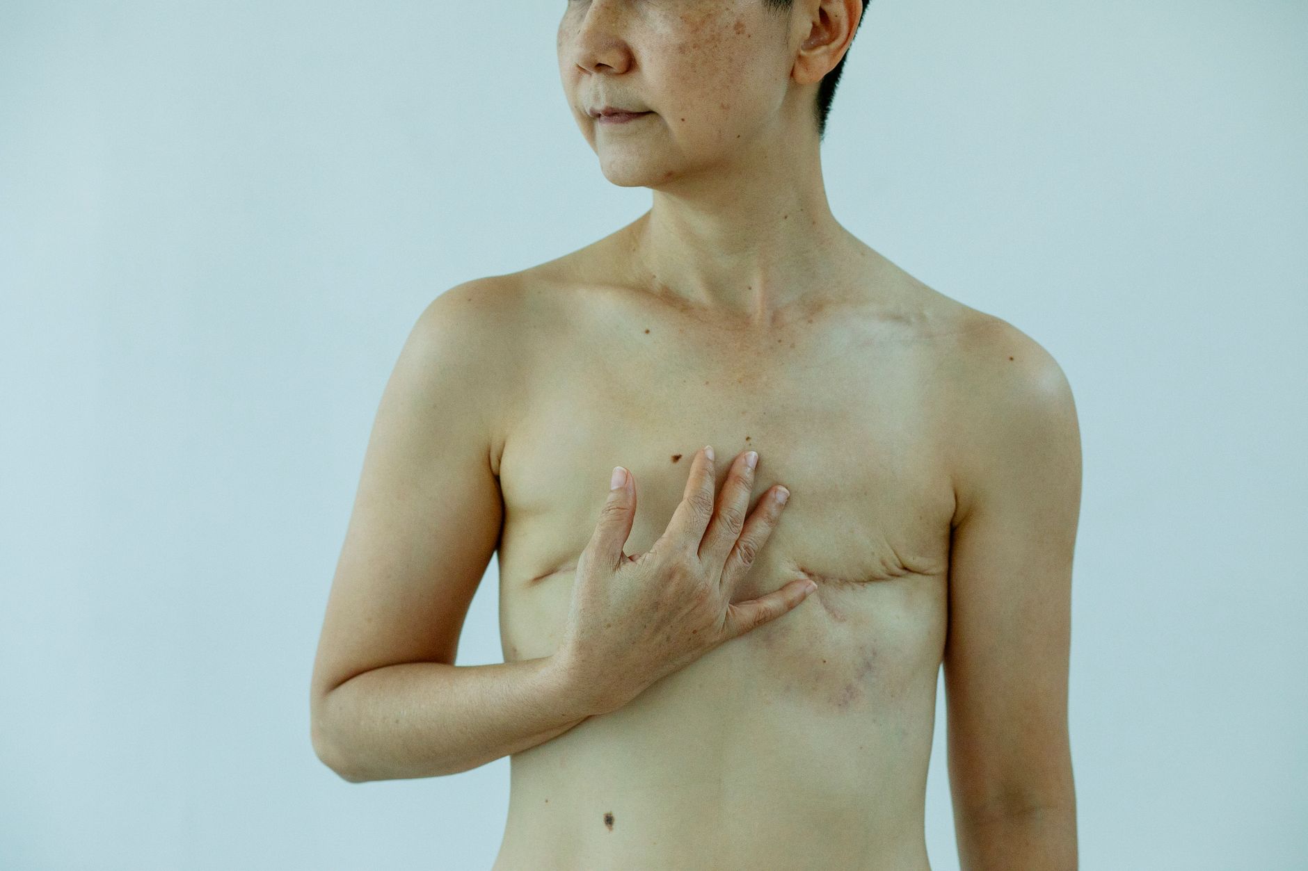 Understanding What Breast Lift Procedure Entails