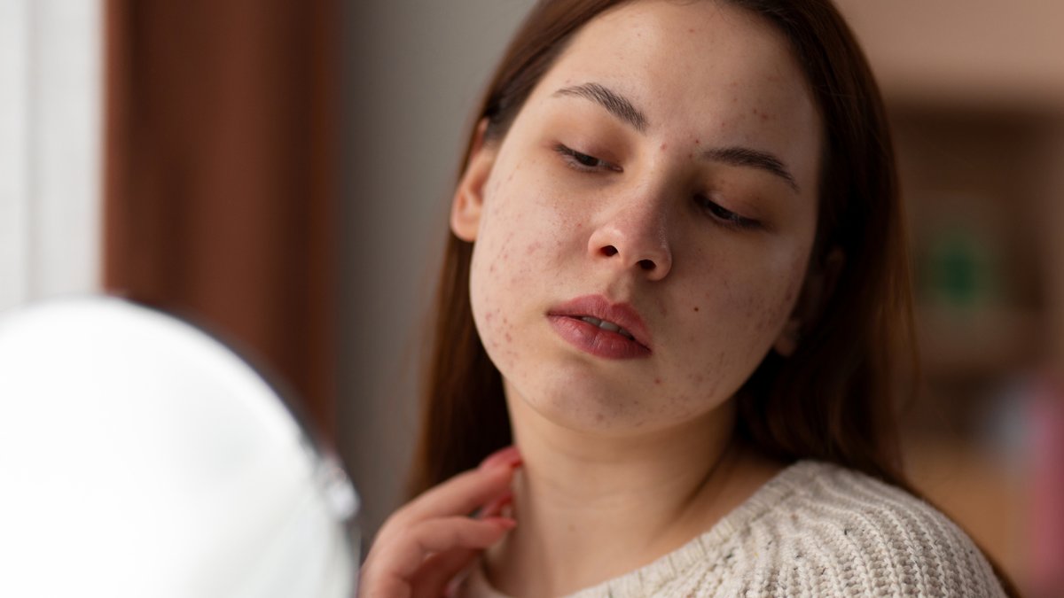 Global gap in dermatology care found Global gap in dermatology care found - dermatology care