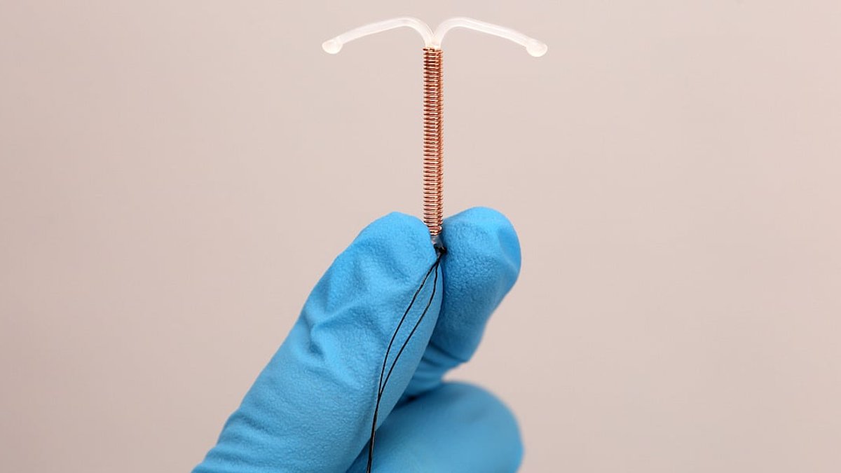 New method reduces IUD insertion pain New method reduces IUD insertion pain - iud insertion