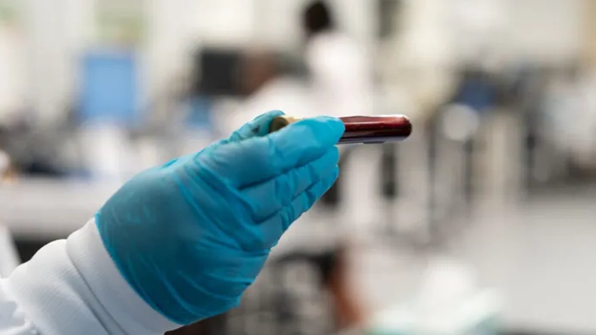 FDA Advisers Back Grail Multicancer Blood Test FDA Advisers Back Grail Multicancer Blood Test - grail multicancer test