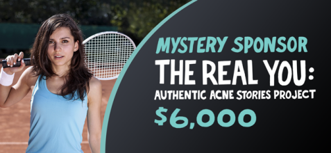 The Real You: Authentic Acne Stories Project