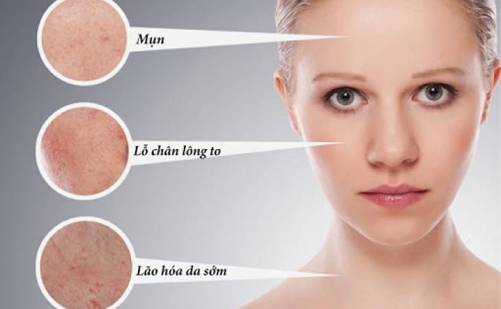 Nhiều tác hại khi bạn không làm sạch da