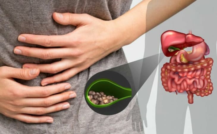 Nhịn ăn sáng thường xuyên sẽ hình thành sỏi ở mật
