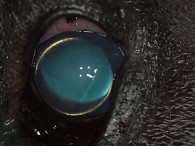 Mi a szemlencse luxáció?