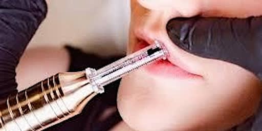 Pittsburg :Hyaluron Pen Training, Learn to Fill in Lips & Dissolve Fat!