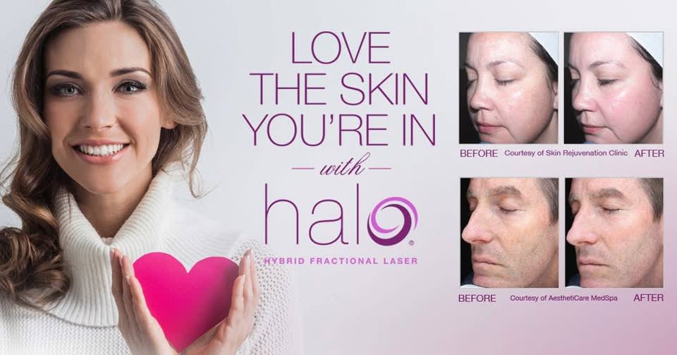 Coolsculpting in Grand Rapids