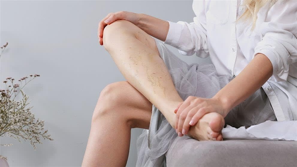 Sclerotherapy for Physicians & Nurses - Philadelphia, PA