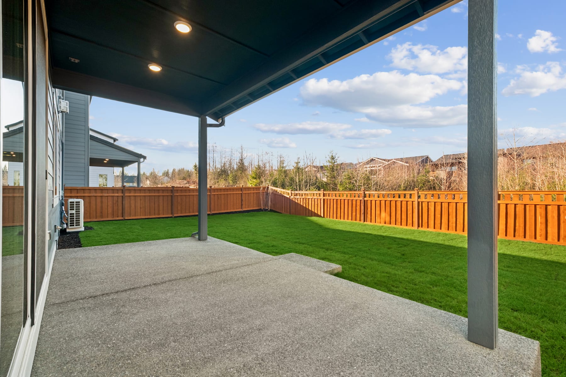 A covered patio with a lush green lawn and a wooden fence in the background, surrounded by a residential neighborhood.