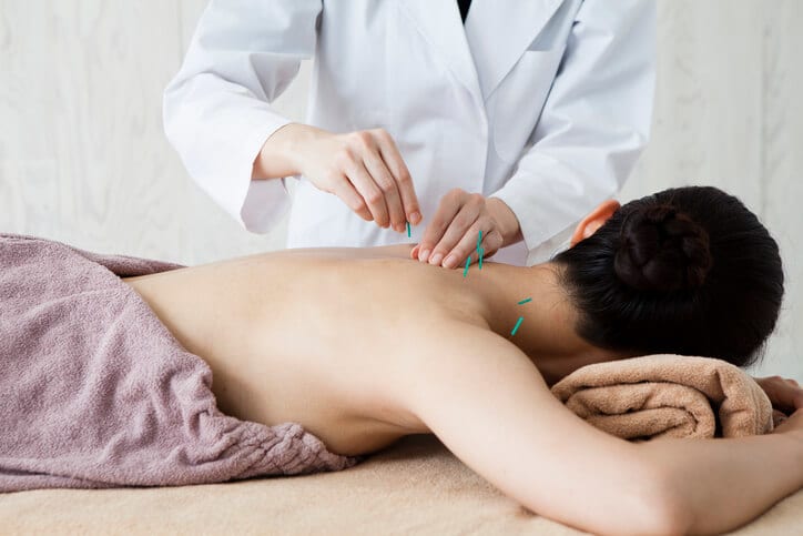 A doctor performing acupuncture treatment