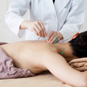 A doctor performing acupuncture treatment