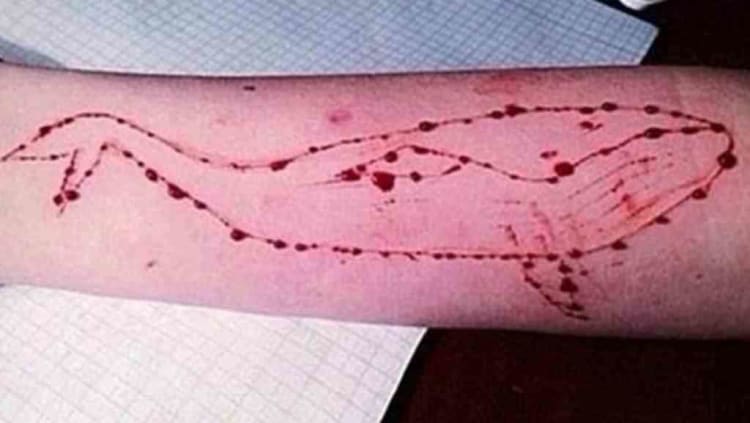 Blue Whale Challenge 1024x577 - Bermain dengan nyawa, kejamnya "Blue Whale Challenge"